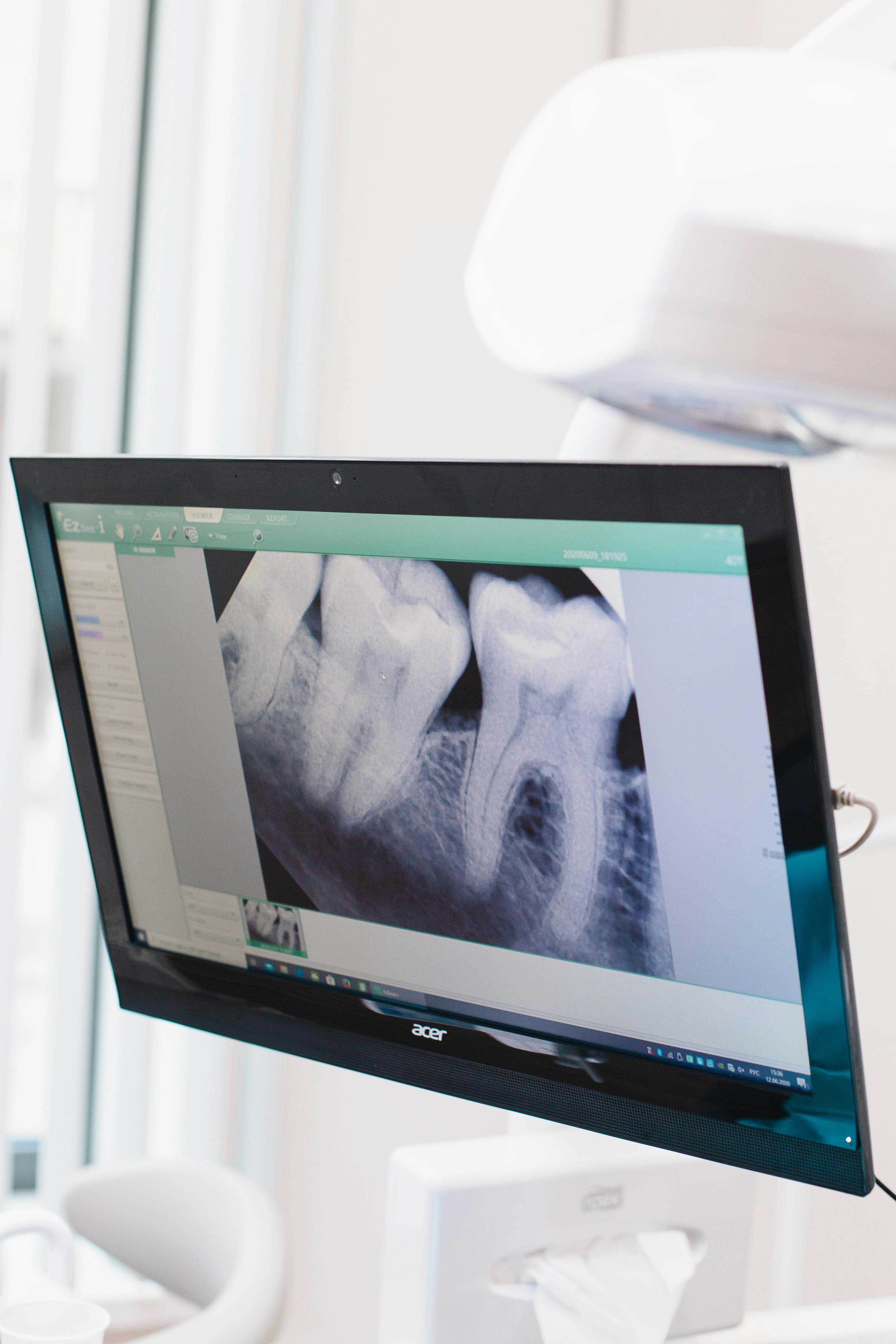 Digital x-ray screen used in AIM's fully digital workflow
